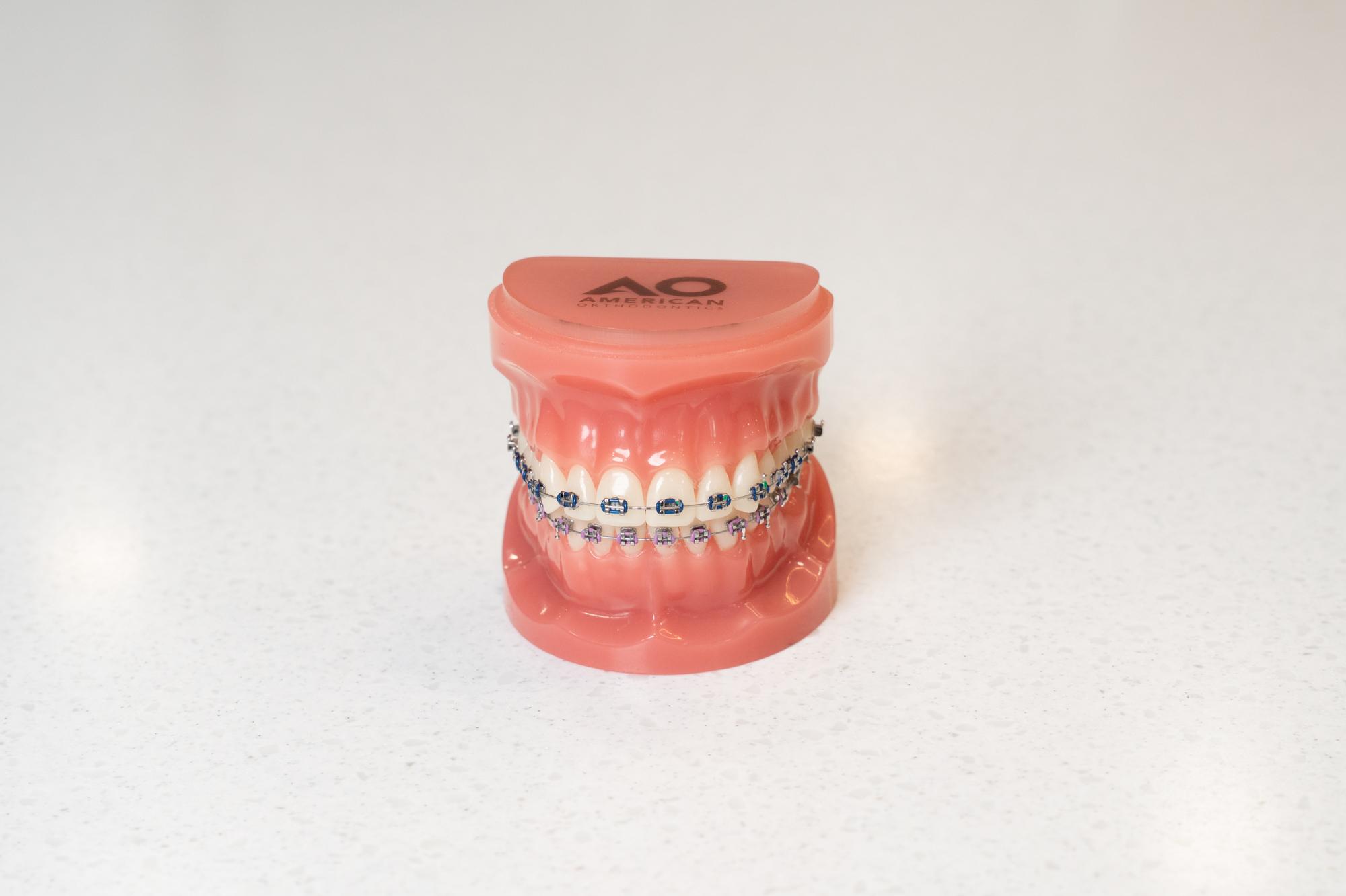 Metal Braces