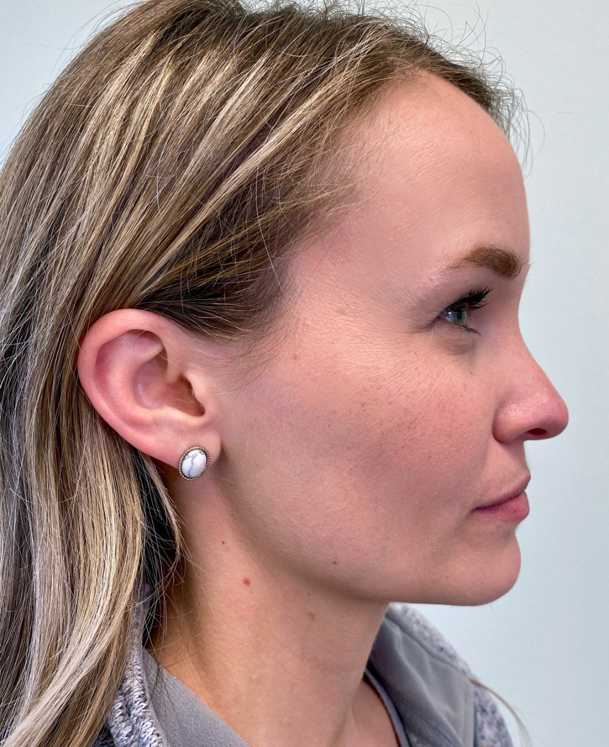 Example photo: side profile