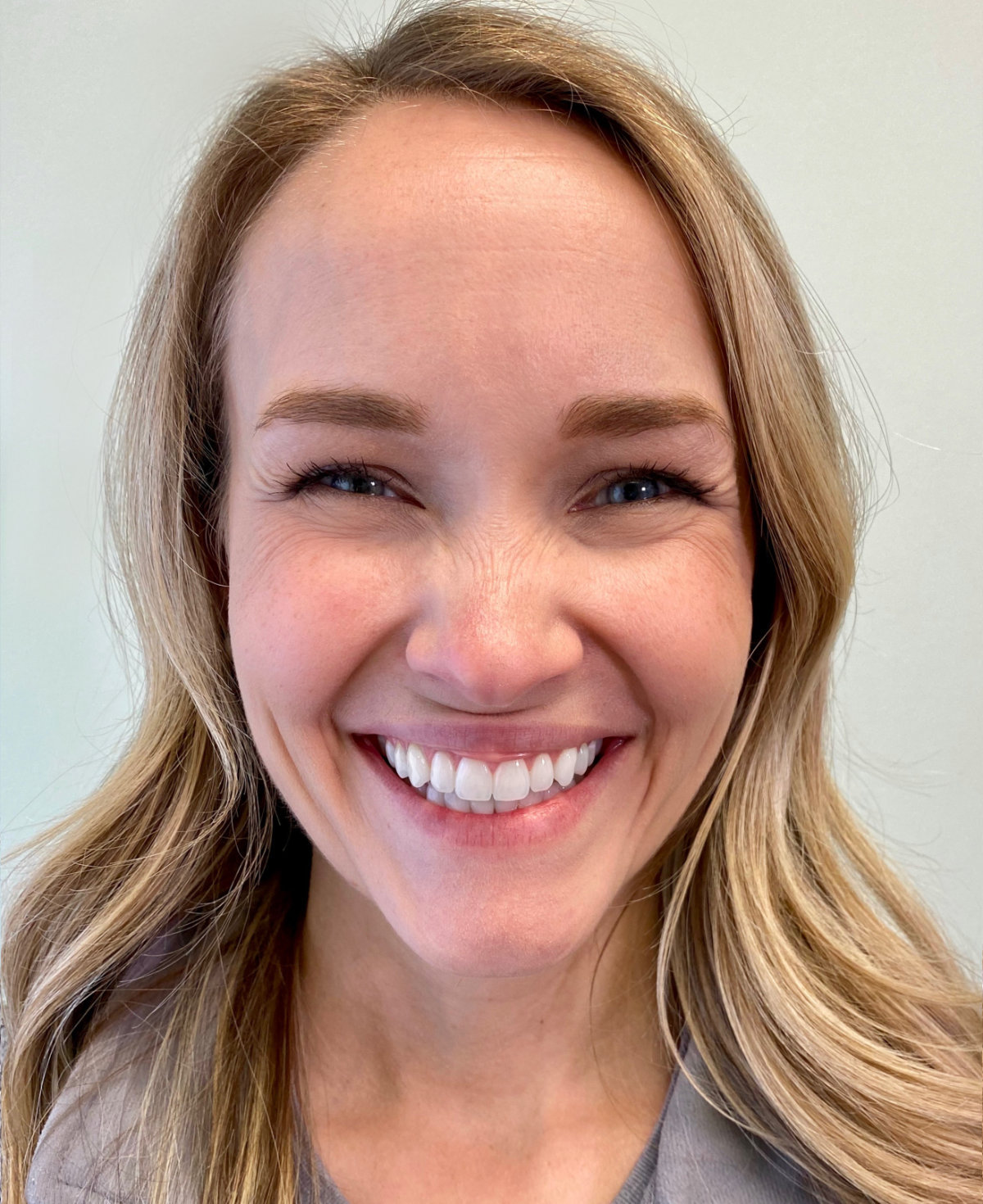 Example photo: full smile, facing the camera